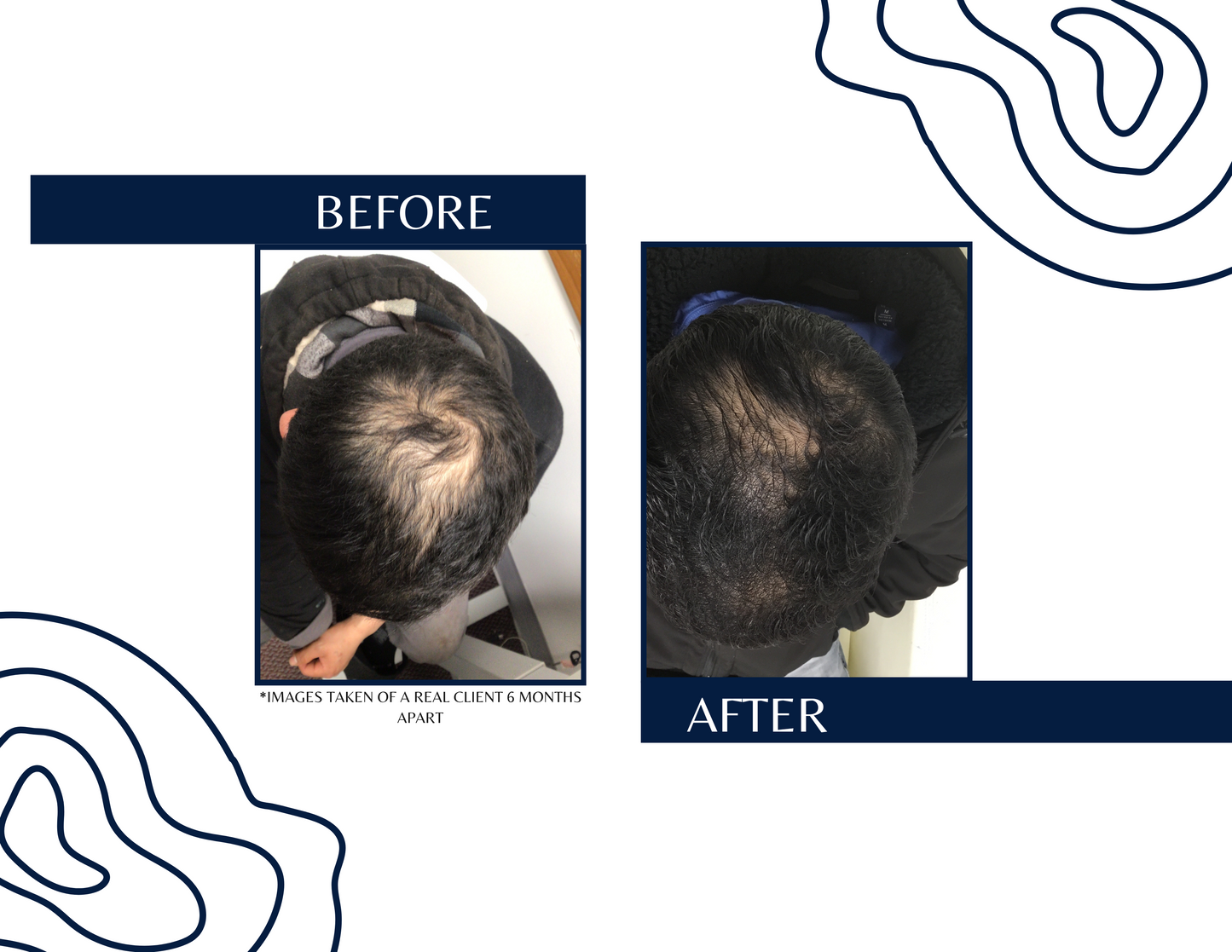 MEGA Shampoo Conditioner Bundle