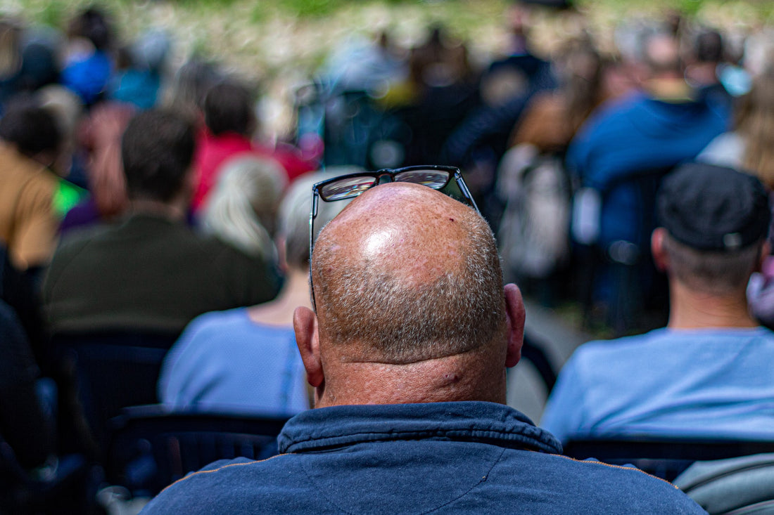 El ciclo de crecimiento del cabello y su caída